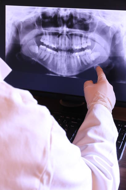 Best Emergency Wisdom Tooth Extraction in Ucon, ID